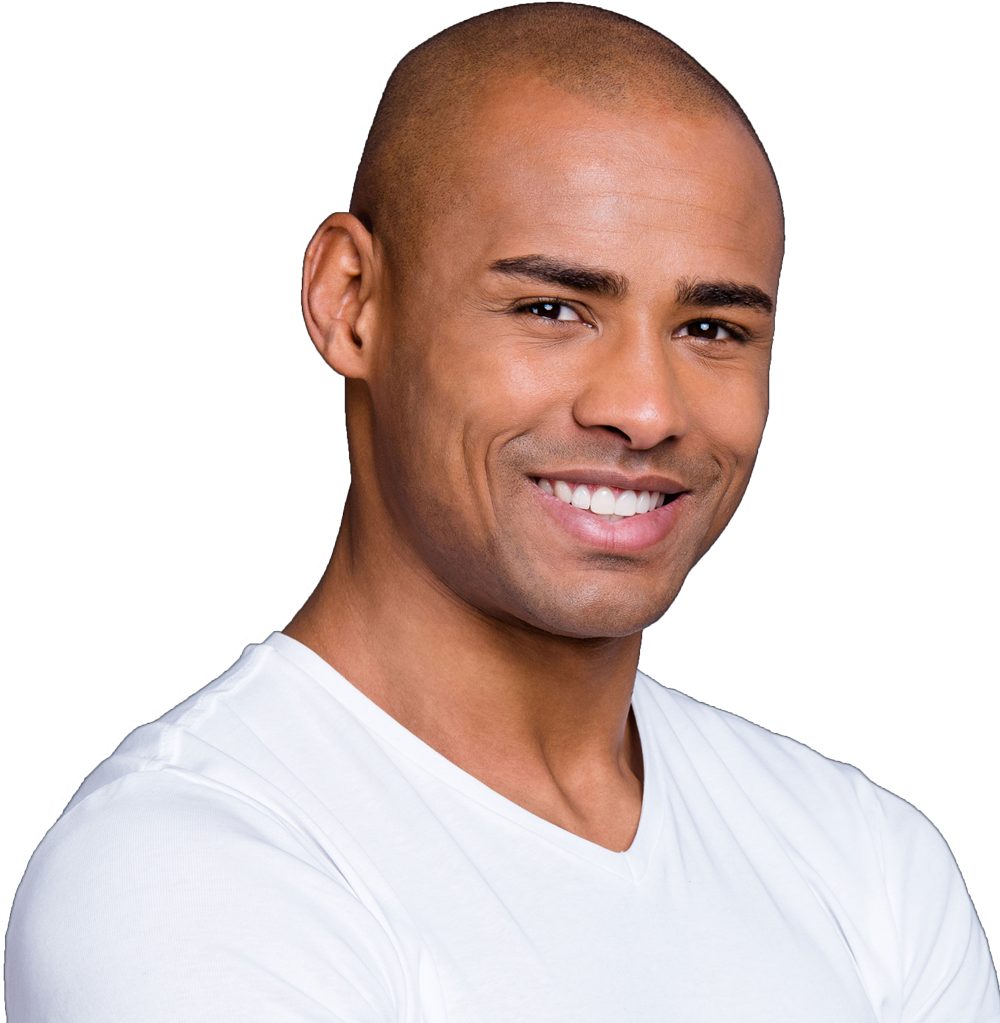 Scalp micropigmentation treatment at simply scalp in purley, south london creating natural-looking hair density.