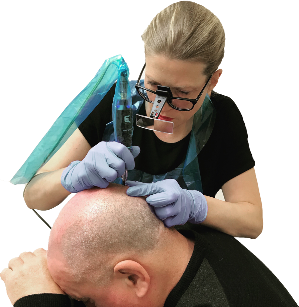Charlotte, scalp micropigmentation artist at simply scalp in surrey, south london, performing smp on a client.