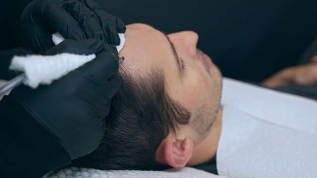 : simply scalp