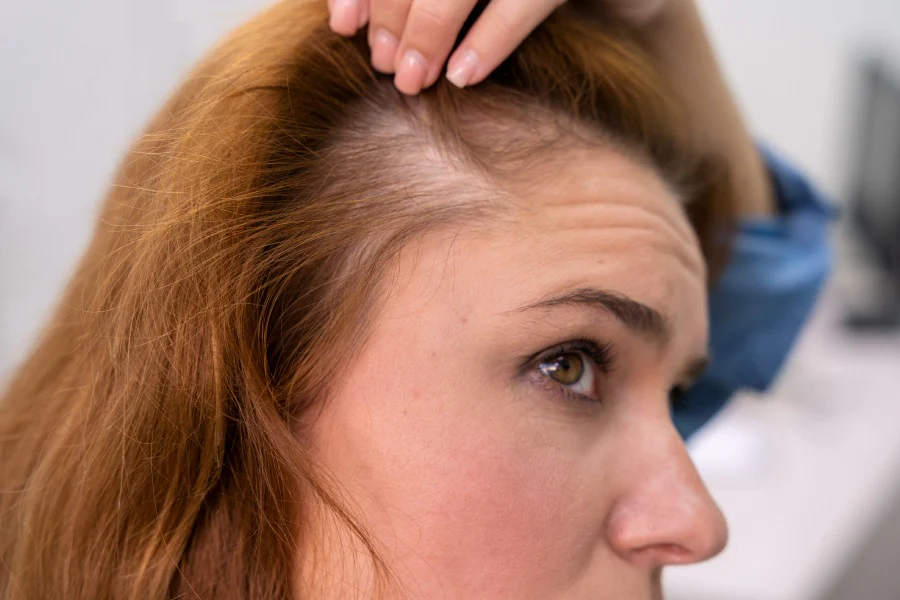 What menopausal hair thinning really calls for: simply scalp